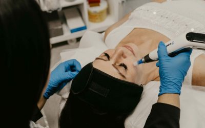 Reverse The Hands Of Time With Microneedling