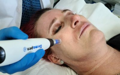 Microneedling is the perfect solution