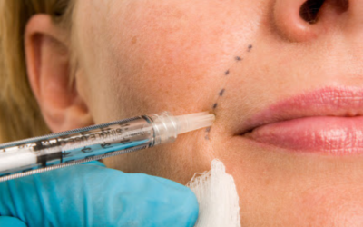 Dermal Fillers – The Injectable Anti-Ager