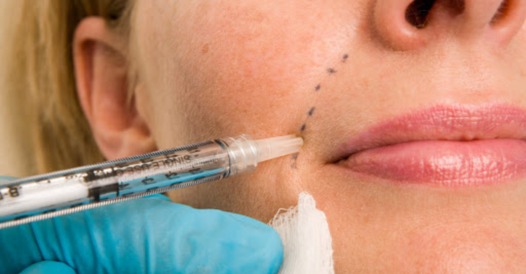 Dermal Fillers – The Injectable Anti-Ager