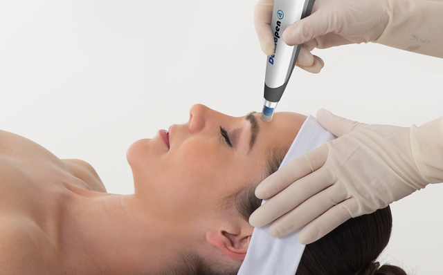 Micro-Needling Mother's Day Special